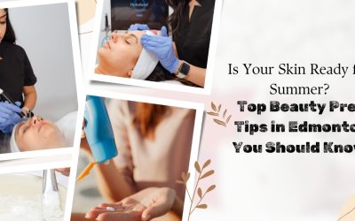 Is Your Skin Ready for Summer? Top Beauty Prep Tips in Edmonton You Should Know!