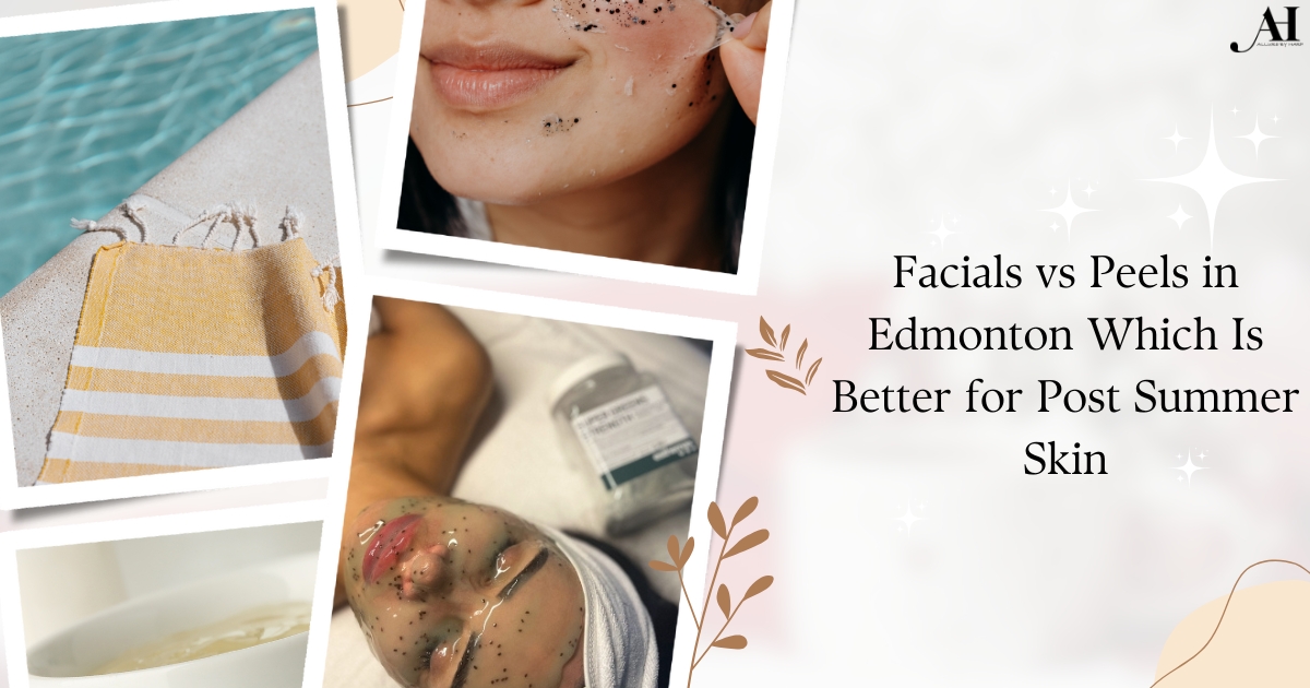 Facials vs Peels in Edmonton Which Is Better for Post Summer Skin