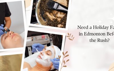 Need a Holiday Facial in Edmonton Before the Rush?
