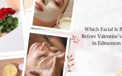 Which Facial Is Best Before Valentine’s Day in Edmonton